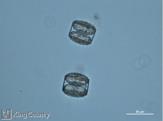 Photo of Thalassiosira punctigera